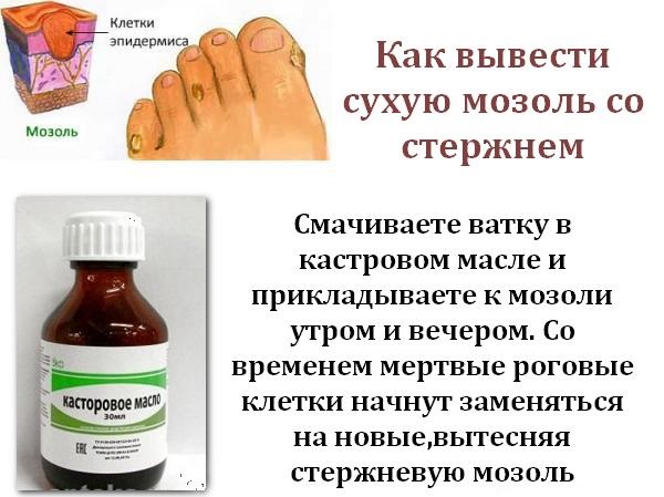 Мозоли и натоптыши