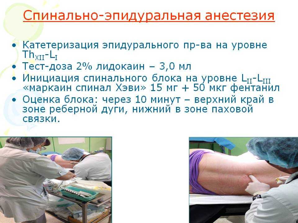 Лекция №1. тема: сестринский процесс в предоперационном и интраоперационном периодах | авторская платформа pandia.ru