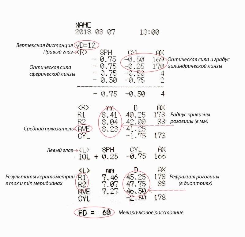 Авитрия глаза: причины и значение