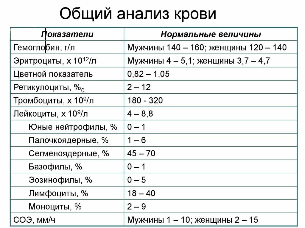 Значение и происхождение слова «безалаберный»