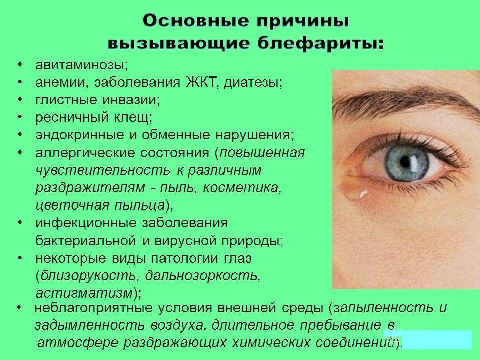 Жжение в глазах, симптомы, причины, лечение.