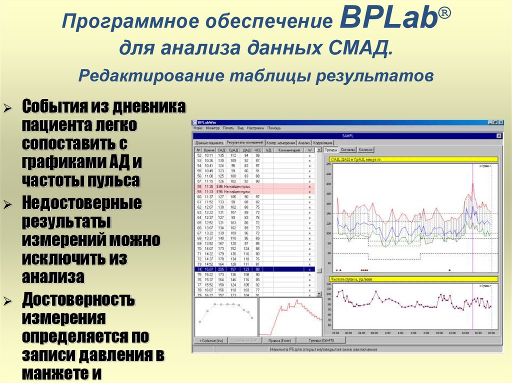 Bplab: что значит суточный монитор pause?